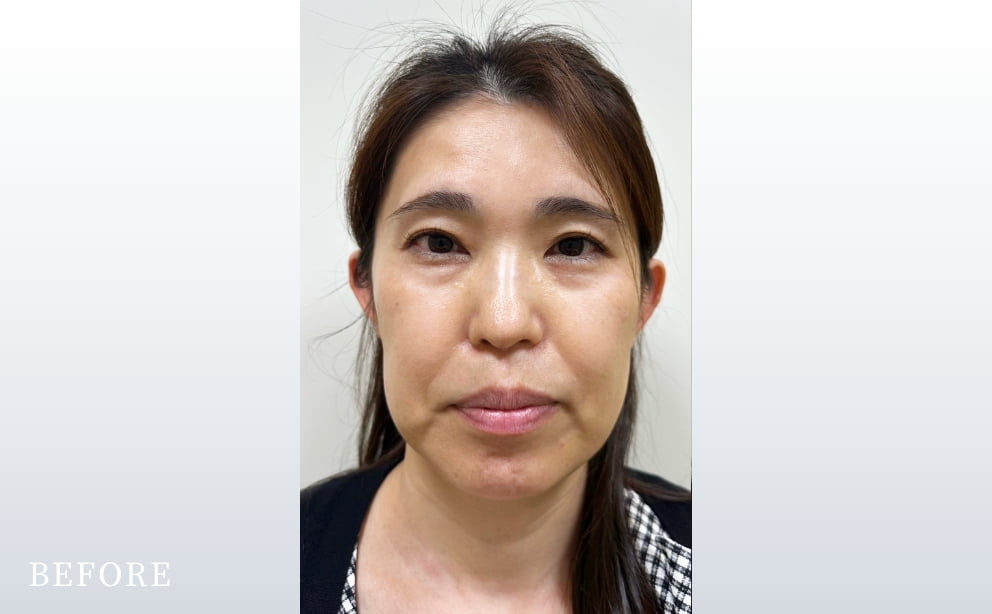 治療前の写真