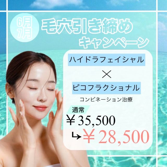 こんにちは🌞
6.7月の新しいキャンペーンのお知らせです📢
ジメジメと湿度が上がってくると肌トラブルも増えてきます😖特に毛穴の詰まりや開きが気になってくる方が多くいらっしゃいます。そんな毛穴のお悩みを解決できる施術がお得に受けられます🉐
ハイドラフェイシャルで毛穴の汚れを除去してからフラクショナルレーザーで毛穴を引き締める最強コンビです。

通常35,500円→28,500円

〈🤍ご予約・お問い合わせ🤍〉
📍みずほ台サンクリニック☎️049-255-3929
池袋から25分🚃
東武東上線みずほ台駅西口より徒歩1分🚶‍♀️
webからもご予約頂けます。